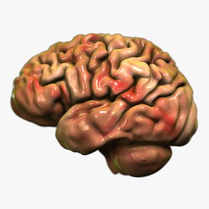 3D Brain Scanline