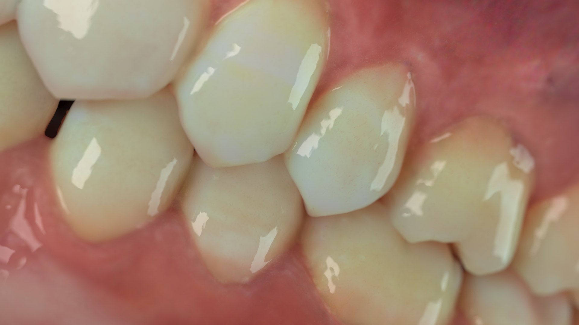 3D model Dentures D https://p.turbosquid.com/ts-thumb/i8/PwG9ZE/e3/05/jpg/1634601638/1920x1080/fit_q87/589bbb9b6b23a6c0bfb6f437024c39ffdf3688c0/05.jpg