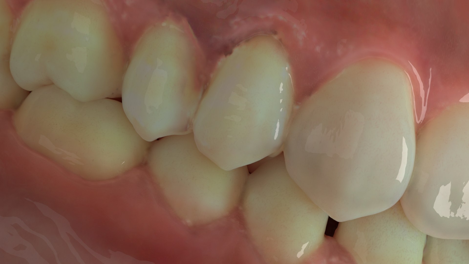 3D model Dentures D https://p.turbosquid.com/ts-thumb/i8/PwG9ZE/jS/04/jpg/1634601641/1920x1080/fit_q87/9a6a14c4a0c84ff8175d1ce96e34d289f4b300b2/04.jpg