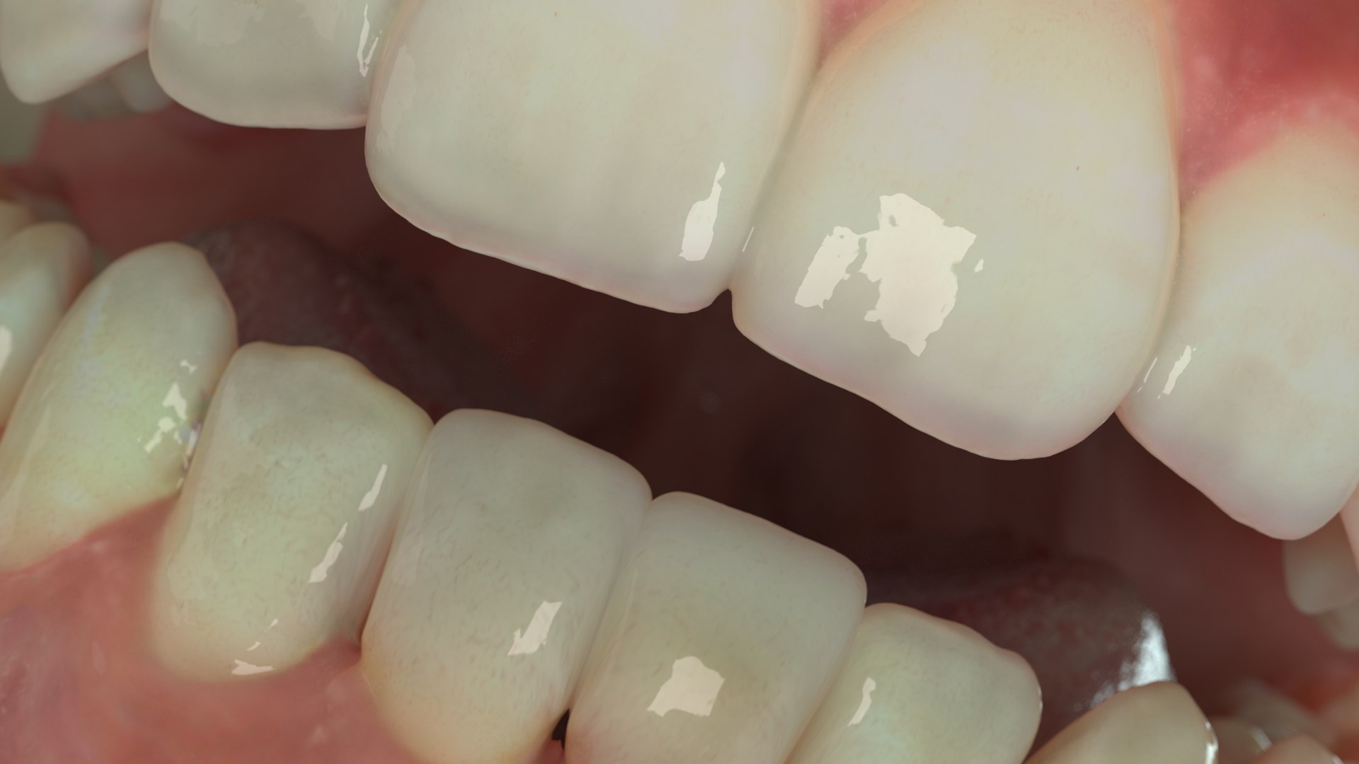 3D model Dentures D https://p.turbosquid.com/ts-thumb/i8/PwG9ZE/w1/03/jpg/1634601640/1920x1080/fit_q87/87f66e91db08637c7ae62462a08f6f23de0e31fa/03.jpg