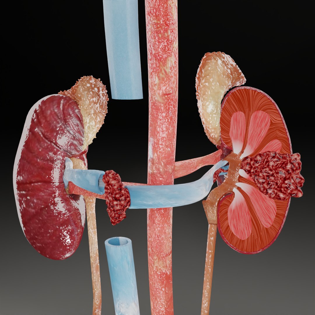 Renal cell carcinoma 3D model https://p.turbosquid.com/ts-thumb/iC/Yp7HFt/R4/1200/png/1667197898/1920x1080/fit_q87/64a1950d71140f28ba81e4152b02985733d7659e/1200.jpg