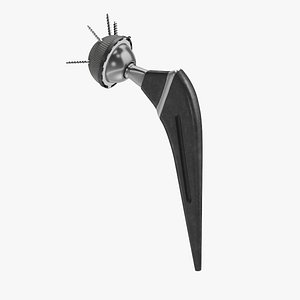 Hip Implant