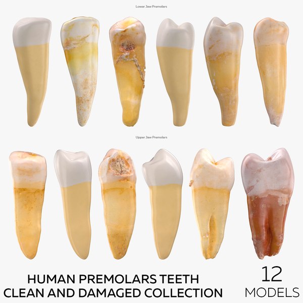 human premolars teeth clean and damaged collection - 12 models