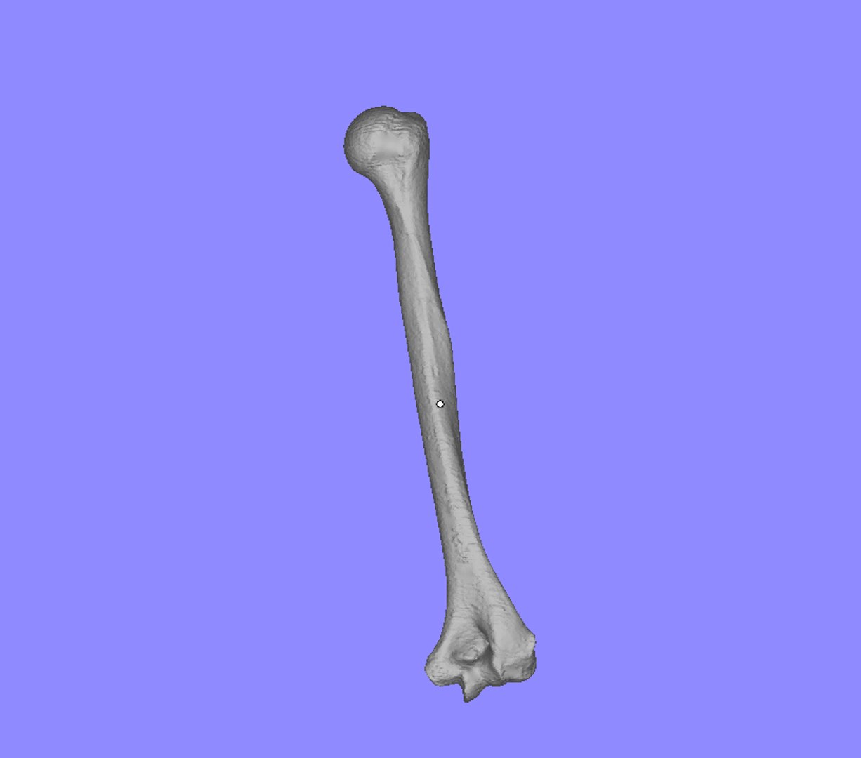 3ds Humerus Ct Scan