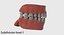 口
