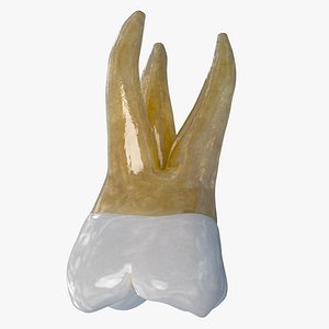 Upper Second Molar