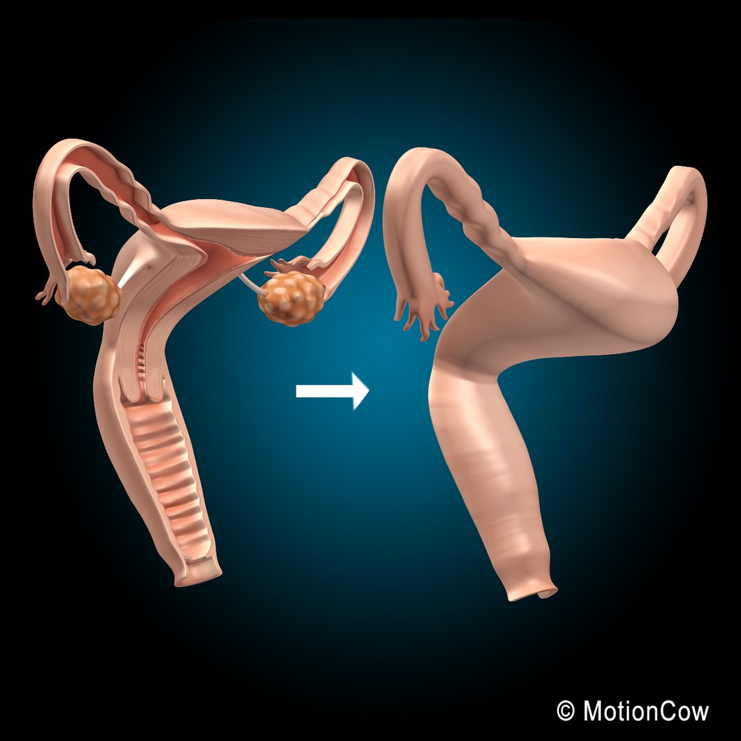 3d female uterus model https://p.turbosquid.com/ts-thumb/iy/D8bgAC/g8fchcU0/uterus_g/jpg/1346141111/1920x1080/fit_q87/b8227ebc195eaa2a233bdd4544b5354aee3bc628/uterus_g.jpg