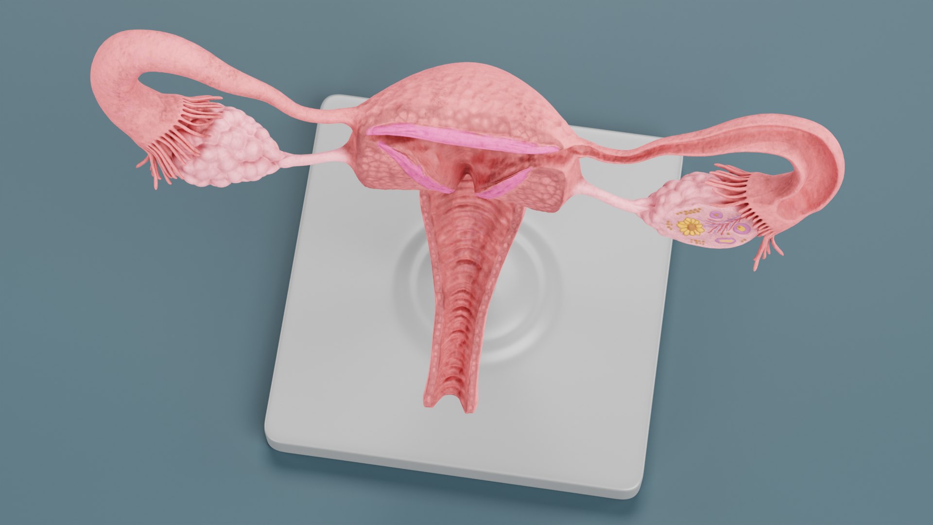 3D Uterus Model Model - TurboSquid 2026882