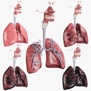 Respiratory System Collection (Smoker's Lungs Stages)