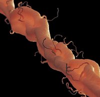 axon with dendrites