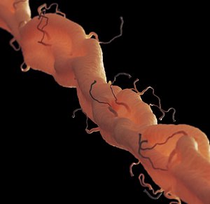 axon with dendrites