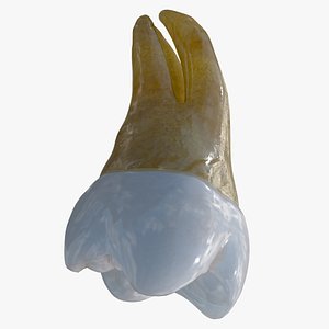 upper molar 3D model