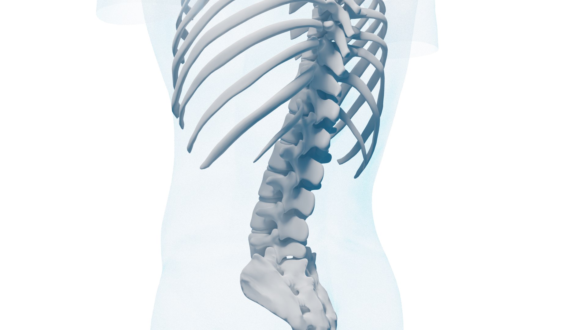3D Scoliosis Skeleton Vs Normal Skeleton - TurboSquid 2128868