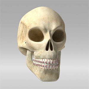 Skull_orthodontic
