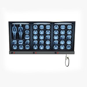 3D X-Ray Film Viewer medical lightbox 3D model model