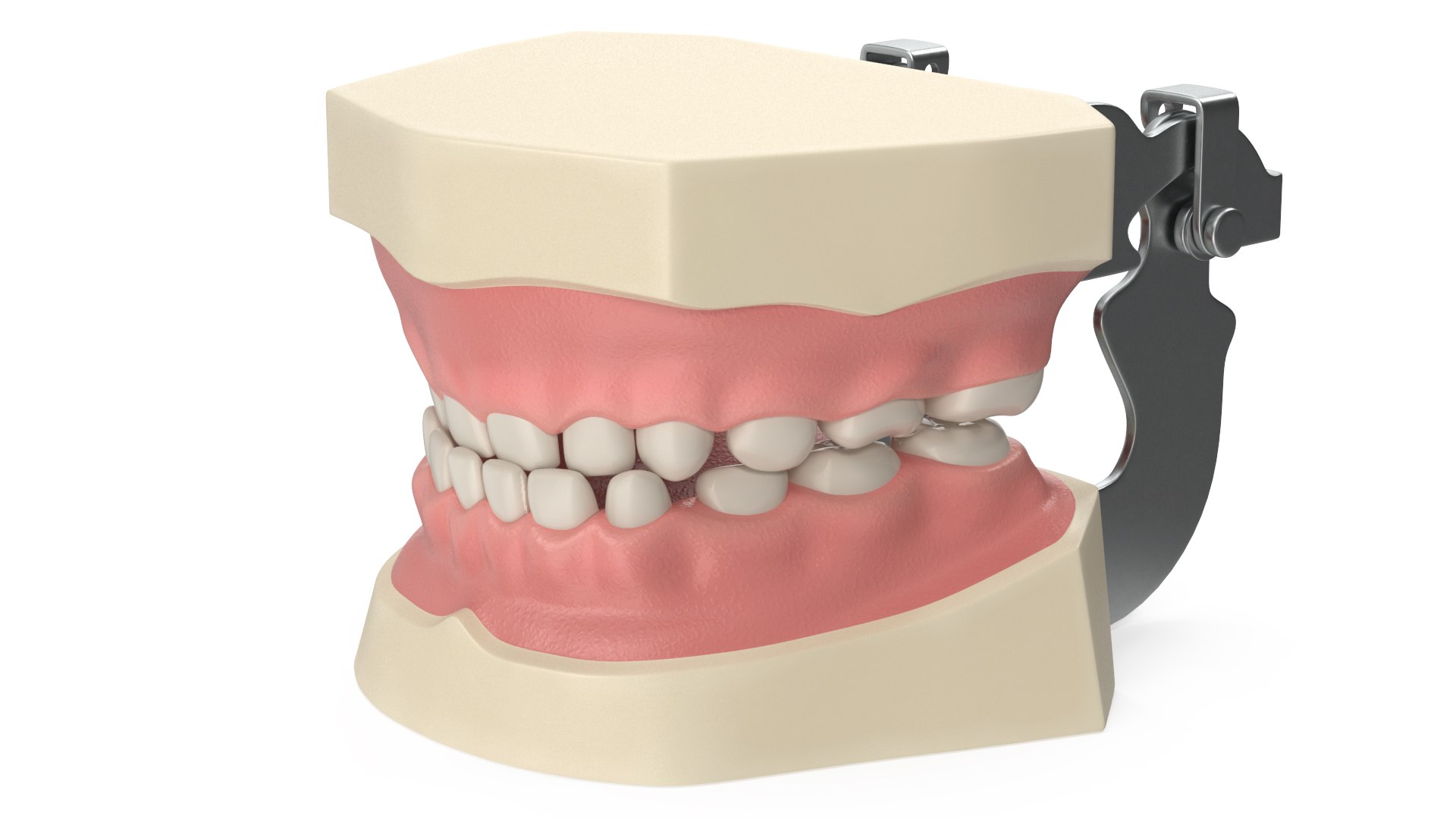 Typodont Teaching Studying Model with Removable Underbite Teeth 3D model preview