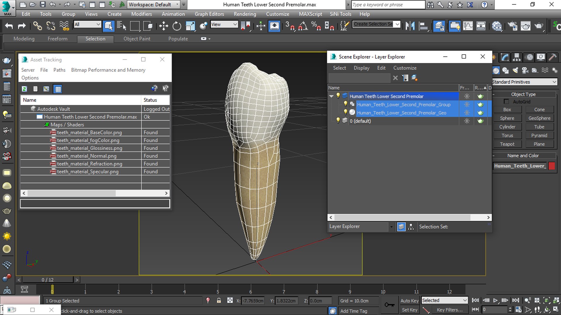 3D human teeth lower second model https://p.turbosquid.com/ts-thumb/ko/q3125K/Xjjf63XX/viewport/jpg/1588533268/1920x1080/fit_q87/bcbcd824e6e7739d52dd665606ade0e63ec97b29/viewport.jpg