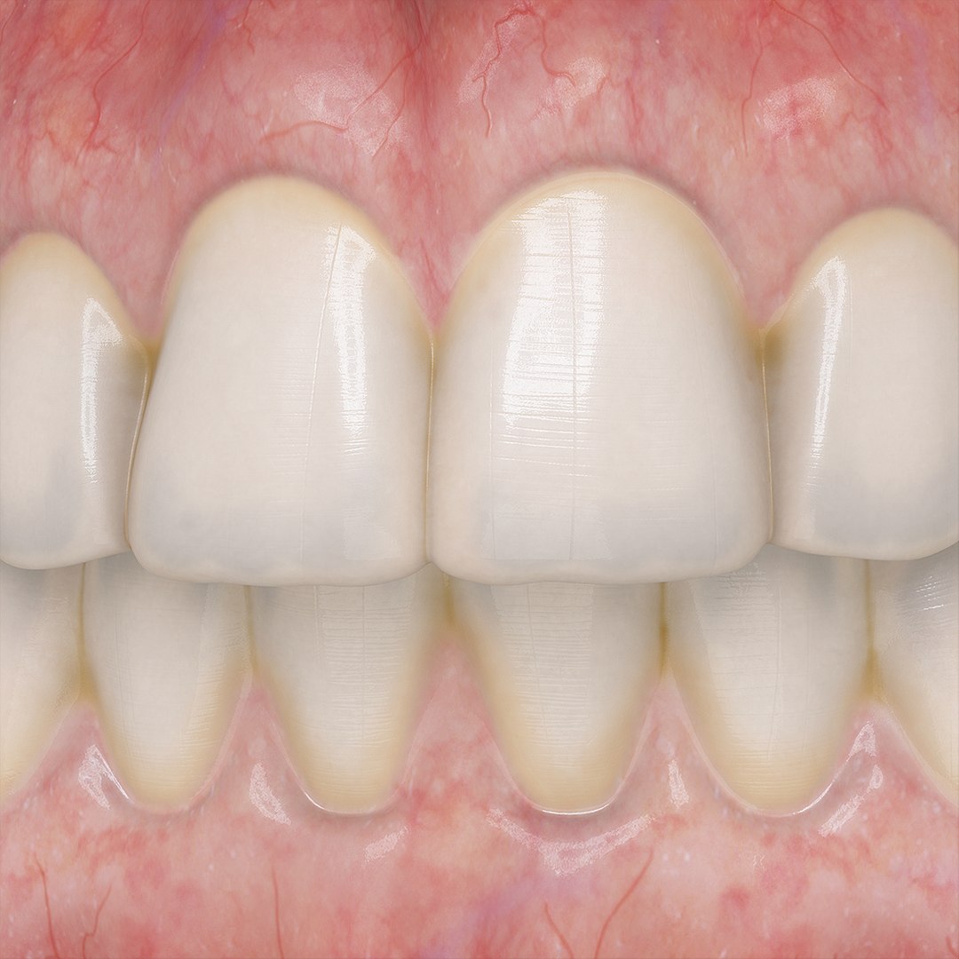 realistic orthodontics medicine 3d model https://p.turbosquid.com/ts-thumb/ks/yD3xwl/7HrmSAFU/closeup/jpg/1424726049/1920x1080/fit_q87/84c096109d7983bbf82b0e85fa21fc0d323c0139/closeup.jpg