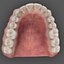 realistic orthodontics medicine 3d model