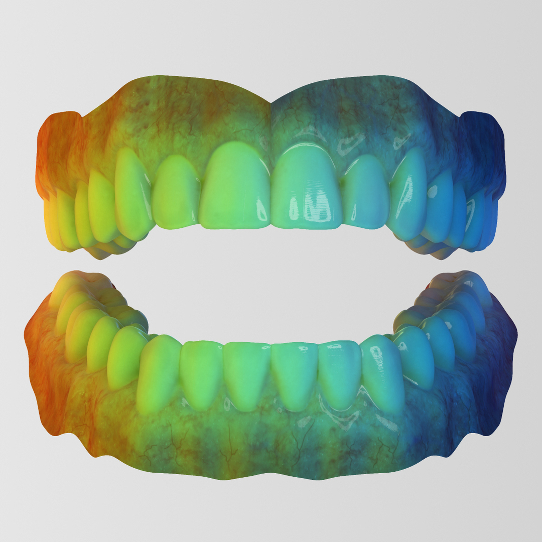 realistic orthodontics medicine 3d model https://p.turbosquid.com/ts-thumb/ks/yD3xwl/L6ELGkoV/cw/jpg/1424726015/1920x1080/turn_fit_q99/672812297e8febe9e422ca9093e563e66fe5efb7/cw-1.jpg