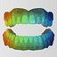 realistic orthodontics medicine 3d model