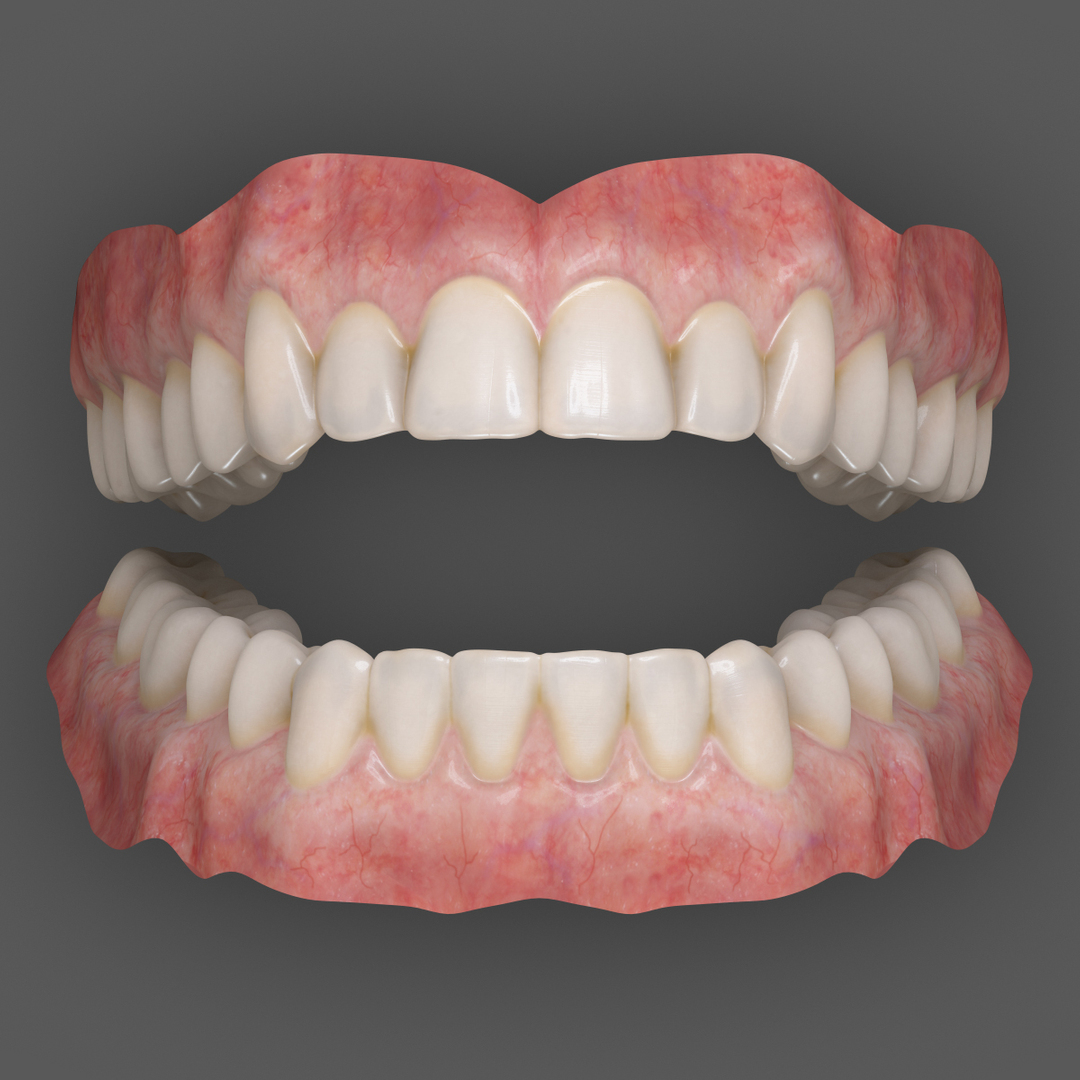 realistic orthodontics medicine 3d model https://p.turbosquid.com/ts-thumb/ks/yD3xwl/SFaSgMsf/light/jpg/1424726103/1920x1080/turn_fit_q99/bcf2c07e56eab737c8ed991c6cb63b1ce26dc25a/light-1.jpg