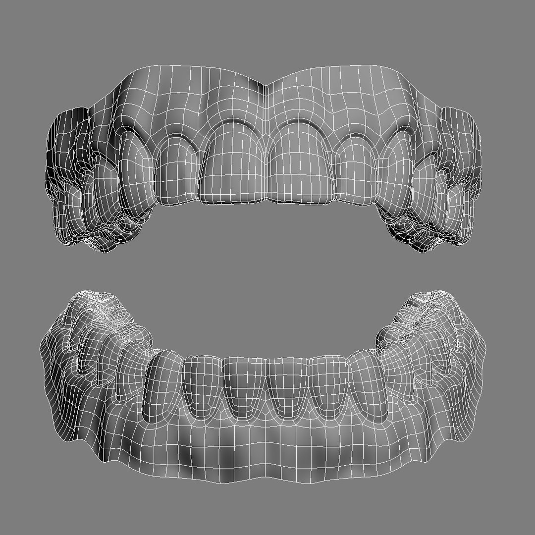 realistic orthodontics medicine 3d model https://p.turbosquid.com/ts-thumb/ks/yD3xwl/UCHWNa8Y/wire_02/jpg/1424726049/1920x1080/fit_q87/1c4216f36bf86d37b8b830754aa2eb19bfe32d10/wire_02.jpg
