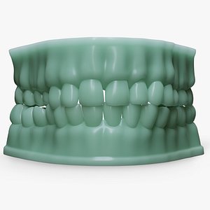 3D Dentures D Mold model