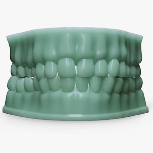 Dentures D Mold