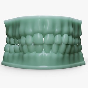 Dentures D Mold