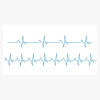 EKG Heartbeat Line