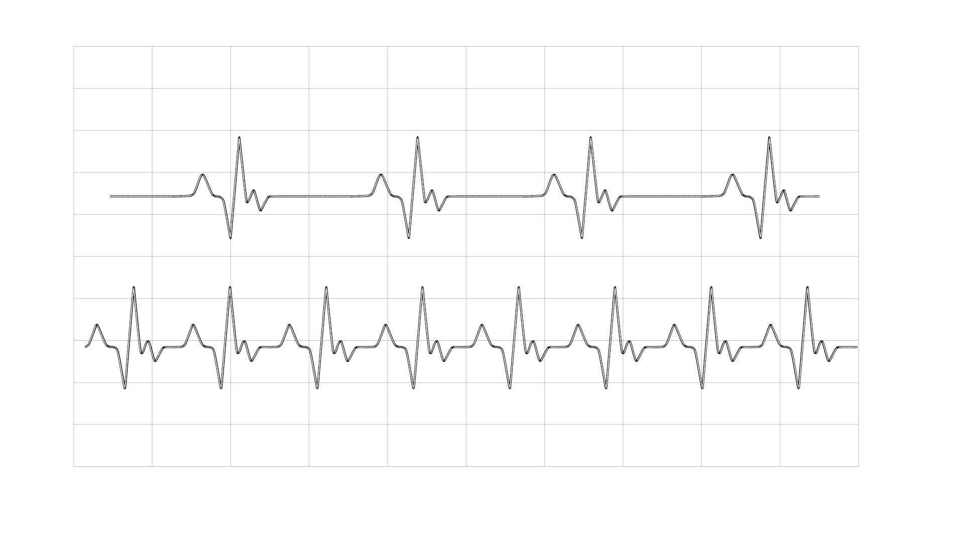 3D EKG Heartbeat Line model https://p.turbosquid.com/ts-thumb/l0/TX2Qnb/xq/wire_ekg_line0001/jpg/1741025245/1920x1080/fit_q87/4652a13fff781d2c6ac9051a6959b40a44bf51ee/wire_ekg_line0001.jpg