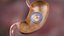 Gastric Balloon
