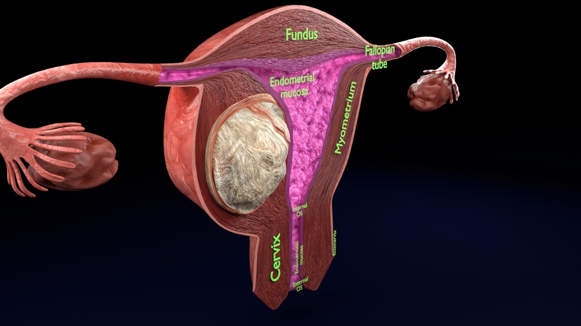 Uterus normal versus  fibroid types 3d set 3D model https://p.turbosquid.com/ts-thumb/l5/FHKntk/3W/4/jpeg/1770829626/1920x1080/fit_q87/900ba772c70a6099920f913c9d65d7fdaf0906af/4.jpg