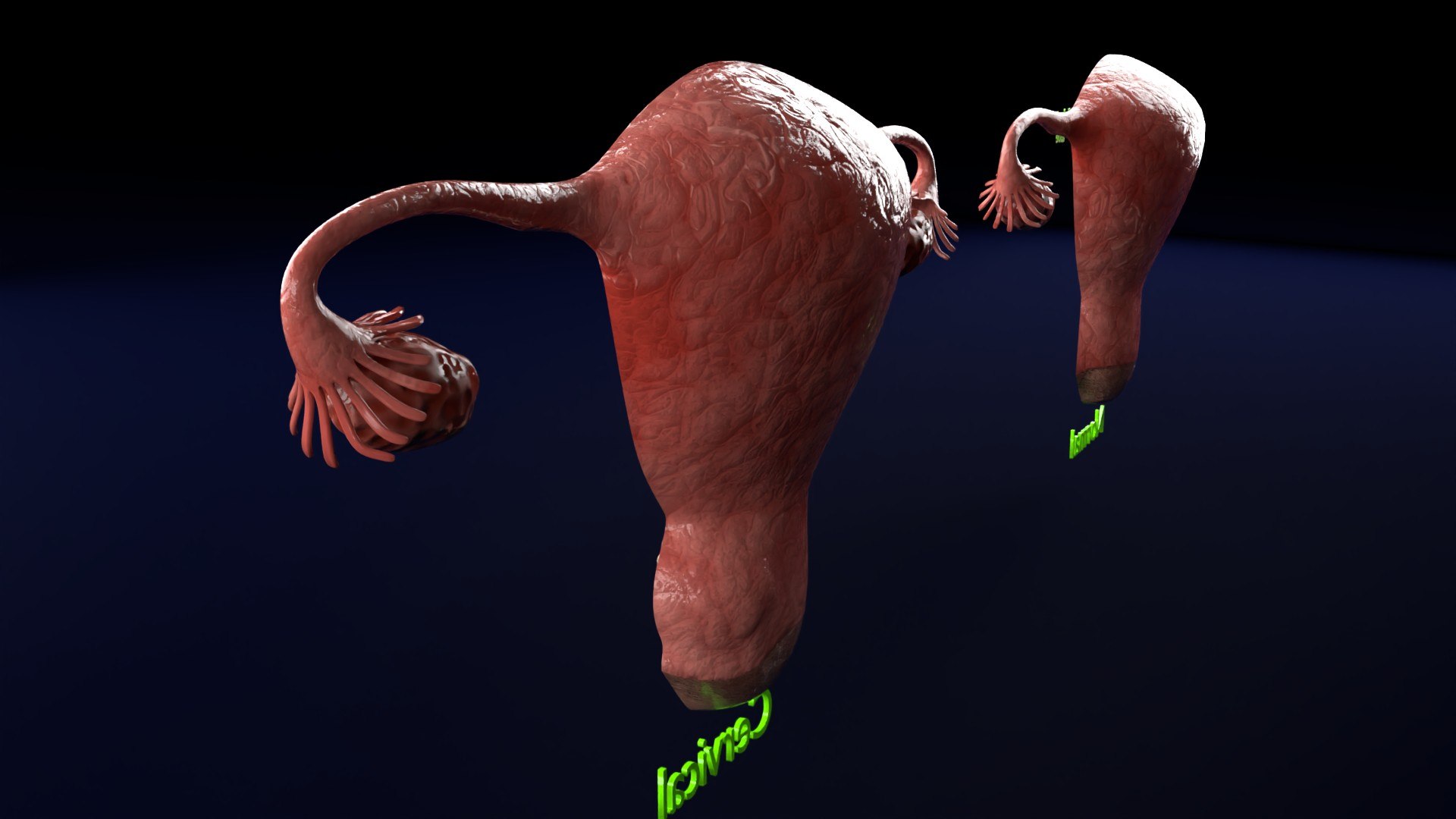 Uterus normal versus  fibroid types 3d set 3D model https://p.turbosquid.com/ts-thumb/l5/FHKntk/9O/cerv0005/jpg/1770829606/1920x1080/fit_q87/a186f1a985e398ed1065cd97edfb52bff7d1bd47/cerv0005.jpg