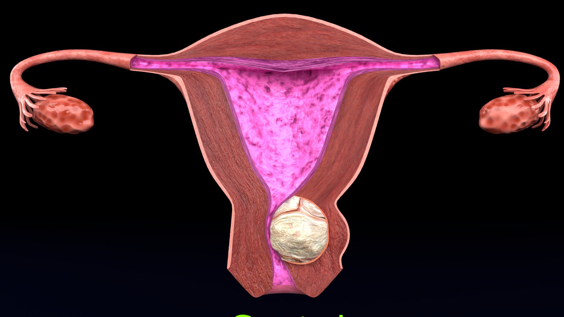 Uterus normal versus  fibroid types 3d set 3D model https://p.turbosquid.com/ts-thumb/l5/FHKntk/Kp/cerv0011/jpg/1770829608/1920x1080/fit_q87/67dfcc391ac9ba91a0e3d903f7ba73937e8d4884/cerv0011.jpg