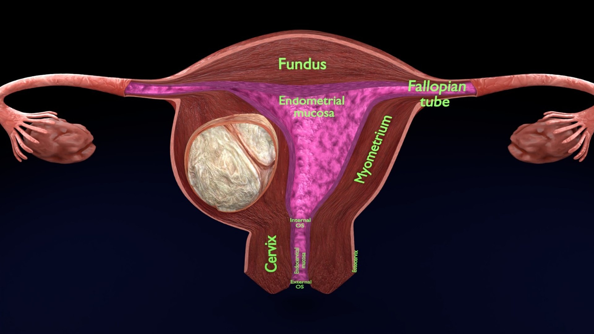Uterus normal versus  fibroid types 3d set 3D model https://p.turbosquid.com/ts-thumb/l5/FHKntk/TE/whatsappimage20260209at11.35.05/jpeg/1770829625/1920x1080/fit_q87/ef1f12fe7ad1c07fb8d7db8733602942499ddb23/whatsappimage20260209at11.35.05.jpg