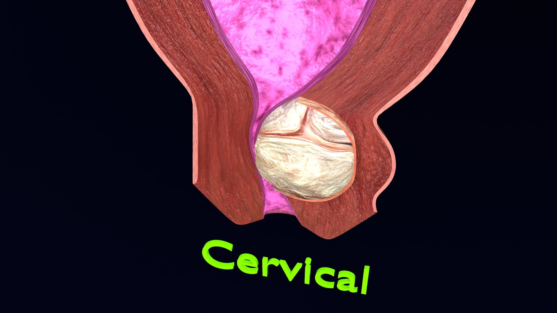 Uterus normal versus  fibroid types 3d set 3D model https://p.turbosquid.com/ts-thumb/l5/FHKntk/fS/cerv0003/jpg/1770829605/1920x1080/fit_q87/07773e8fb517c8cd78b5dbcd2d6f5b4b30967c8f/cerv0003.jpg