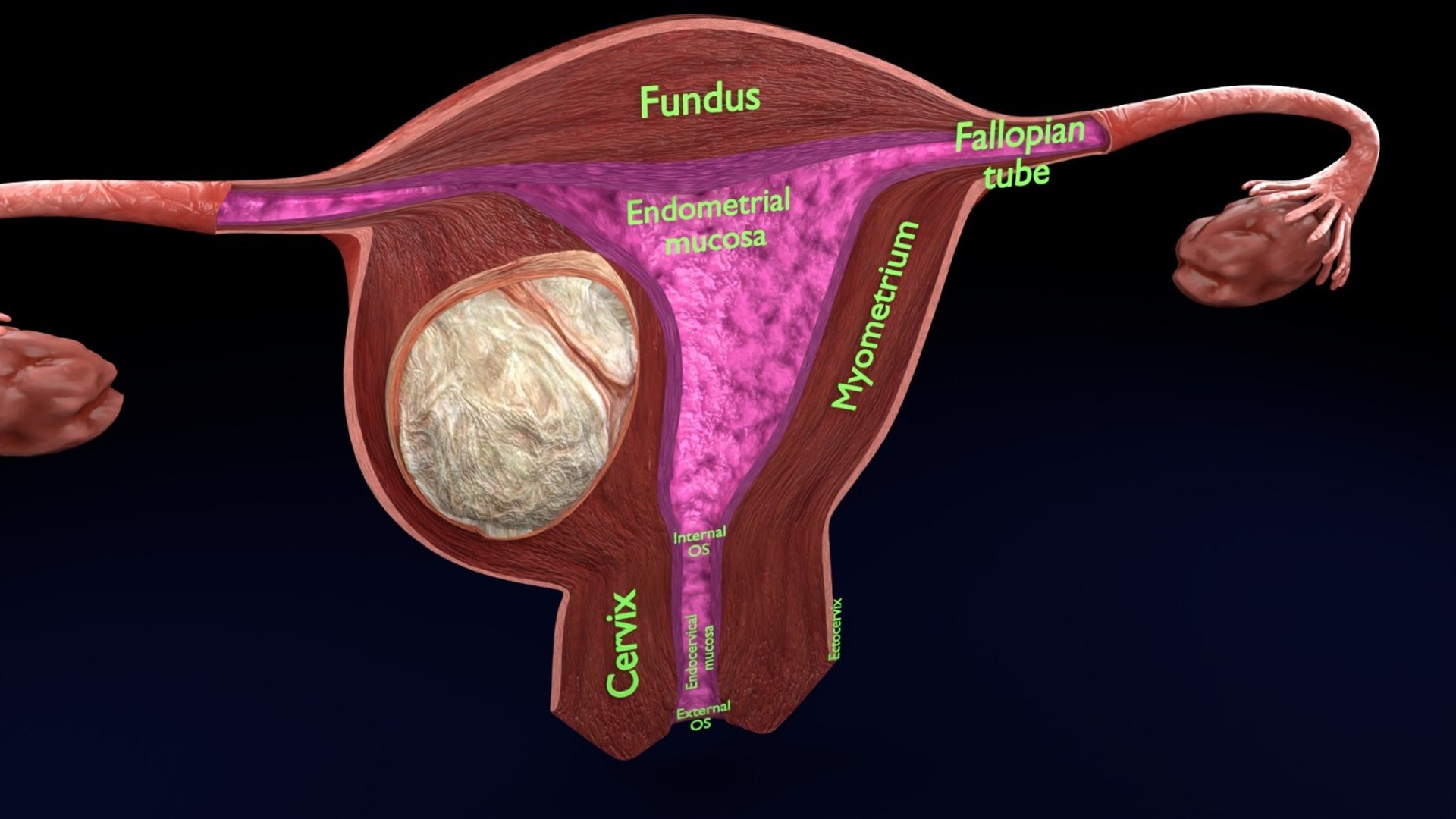 Uterus normal versus  fibroid types 3d set 3D model https://p.turbosquid.com/ts-thumb/l5/FHKntk/ic/3/jpeg/1770829626/1920x1080/fit_q87/961e33dd9e3cf7bcb5f8fb68aef678ecdc78b7f9/3.jpg