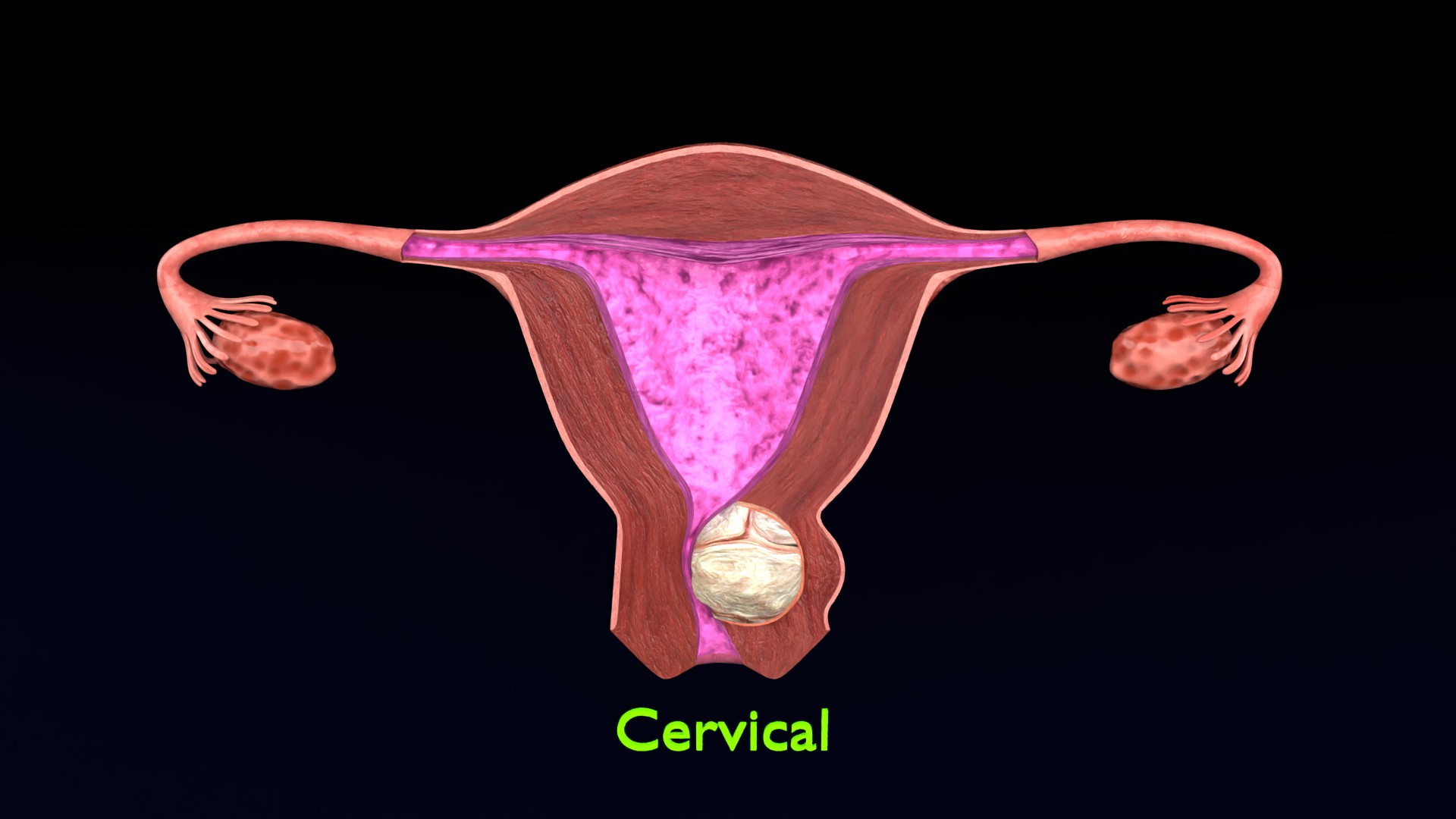 Uterus normal versus  fibroid types 3d set 3D model https://p.turbosquid.com/ts-thumb/l5/FHKntk/ll/cerimage/jpg/1770829722/1920x1080/turn_fit_q99/04527a62d0347a4e82380a6932b75fbccbfa11fa/cerimage-1.jpg