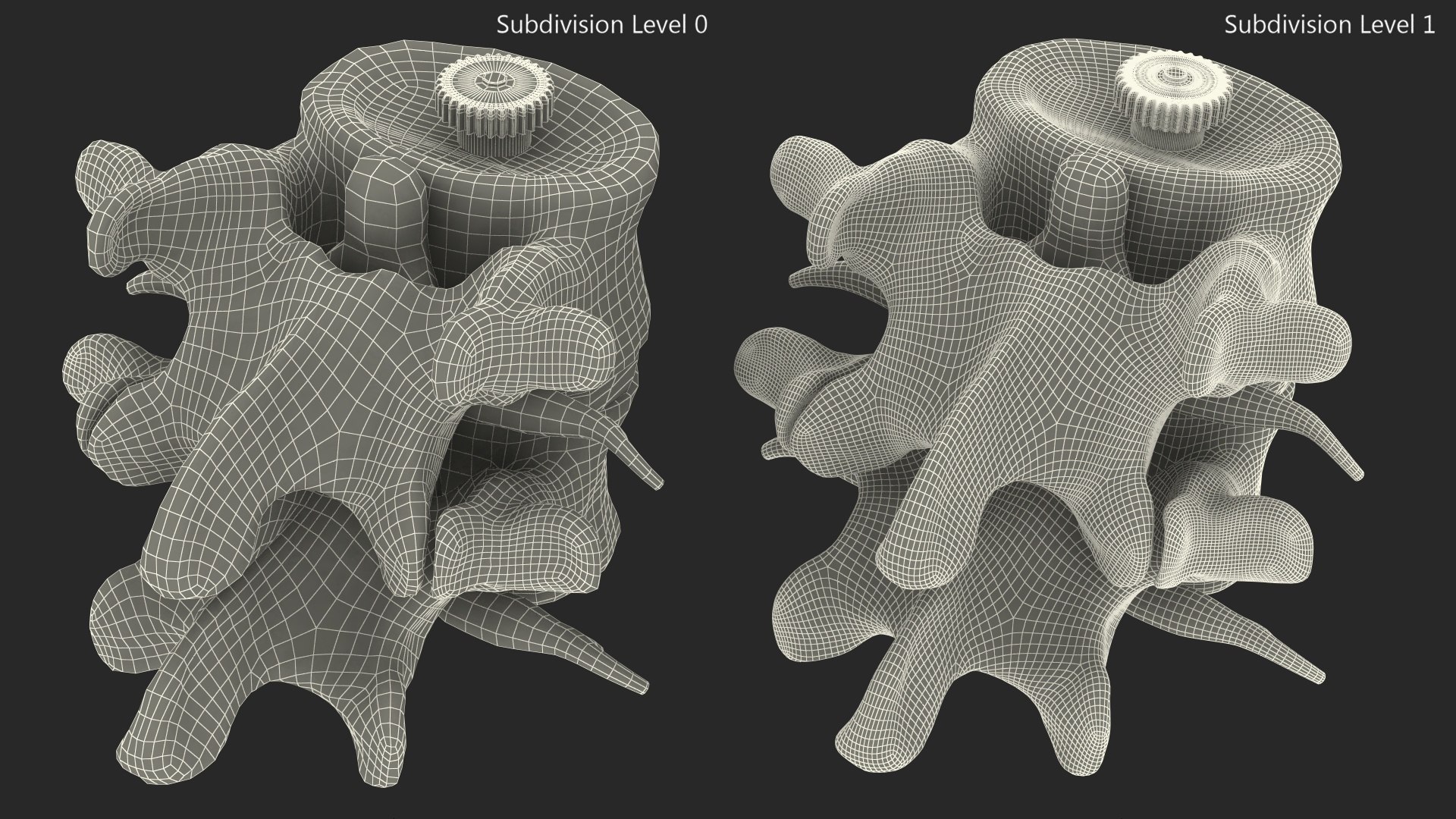 3D Part Of Spinal Column With Hernia Model - TurboSquid 2047604