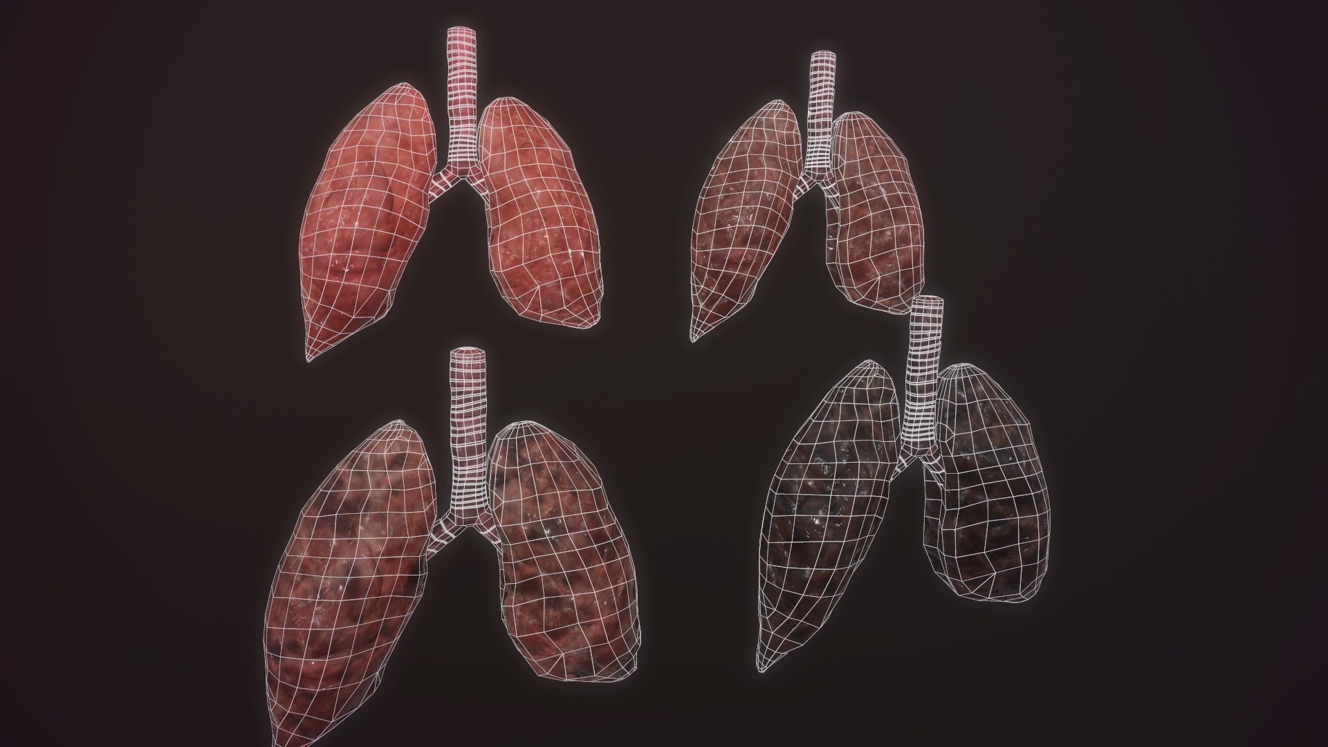 3D model animation medical https://p.turbosquid.com/ts-thumb/lG/TyaA5G/2GrlHwvR/screenshot030/jpg/1572664199/1920x1080/fit_q87/ed641dc503bbed5e7540dc1303058c126eeb067e/screenshot030.jpg