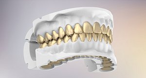 3D Dental Jaws Replica with Detachable Teeth