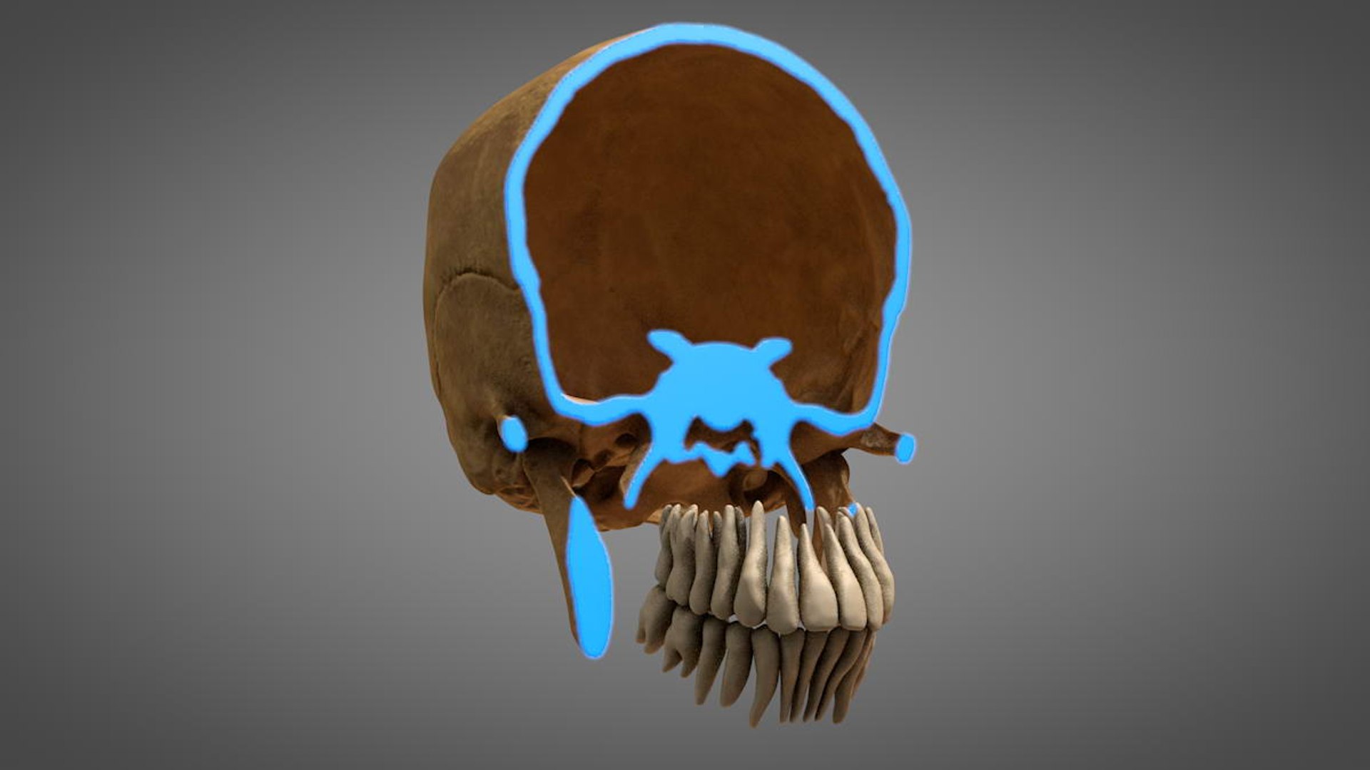 Anatomical Human Skull Teeth 3d Model Turbosquid 1407871