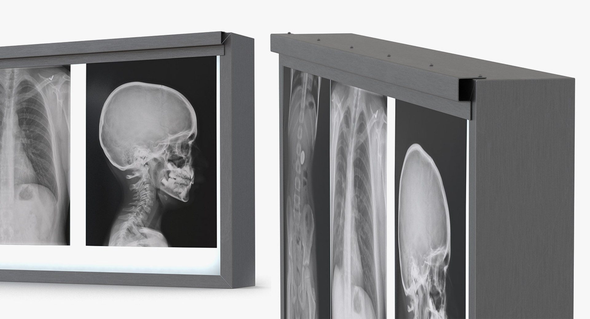 medical equipment 7 model https://p.turbosquid.com/ts-thumb/mC/SjsVHr/AzGCKrkk/medicalequipmentcollection7c4dmodel194/jpg/1599674756/1920x1080/fit_q87/d3d6fc1a5d0e818c1c133d0e0958efb825d5d482/medicalequipmentcollection7c4dmodel194.jpg