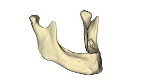 Edentulous Human Mandible