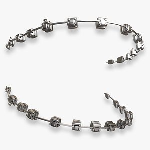 3D Dental Braces