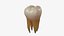Dente molar de esmalte