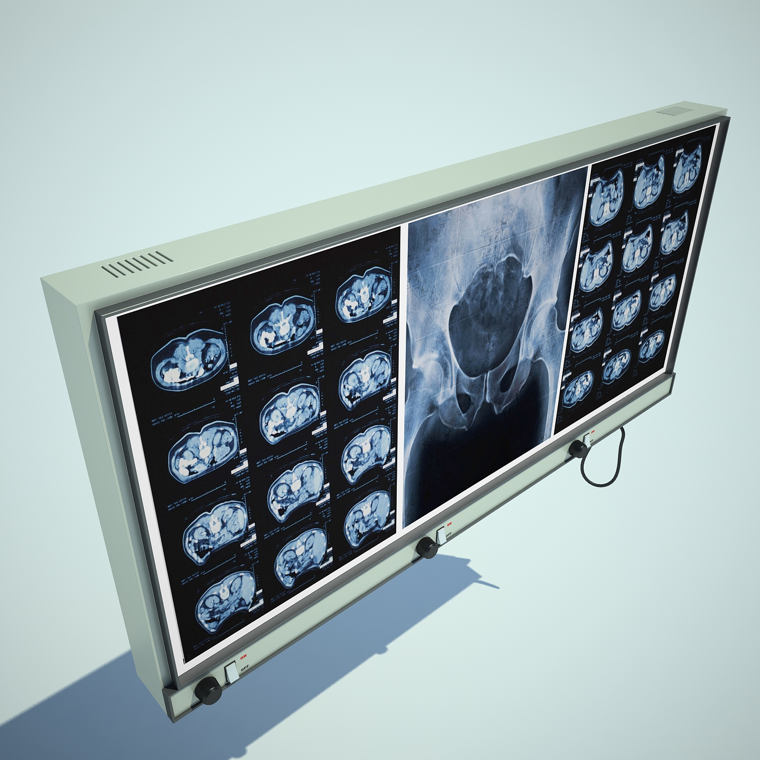 3d model of x-ray x