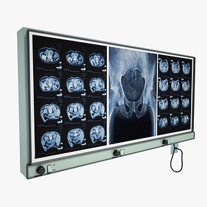 X-ray monitor